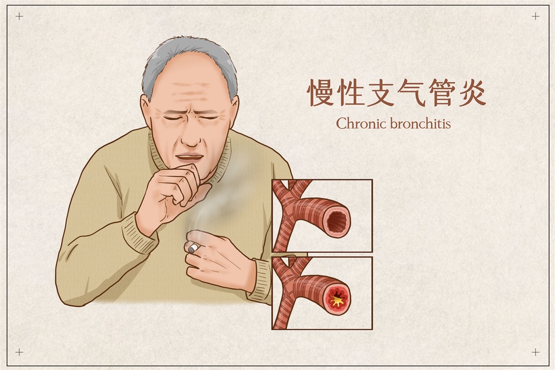 茶葉批發(fā)丨養(yǎng)生茶丨艾條的作用丨艾灸養(yǎng)生